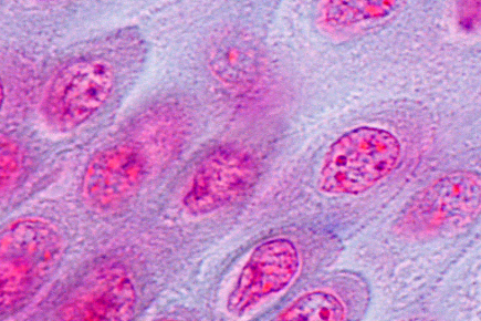 A Case of Severe Hyperkalemia.