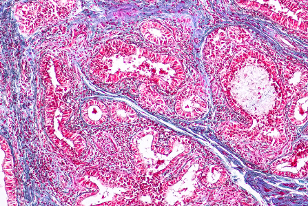 Recovery Time After Hemodialysis.