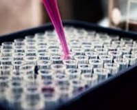 Genetic Testing in Cystic Kidney Disease