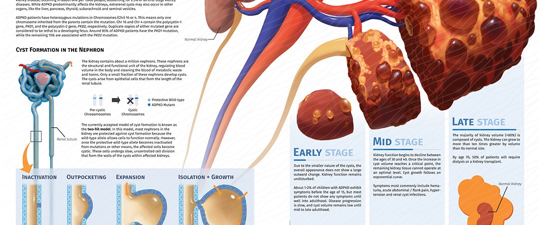 Understanding Severe Kidney Disease in Pediatric Autosomal
