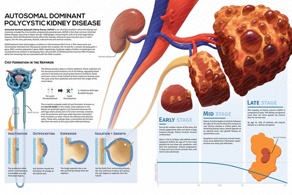 Understanding Severe Kidney Disease in Pediatric Autosomal